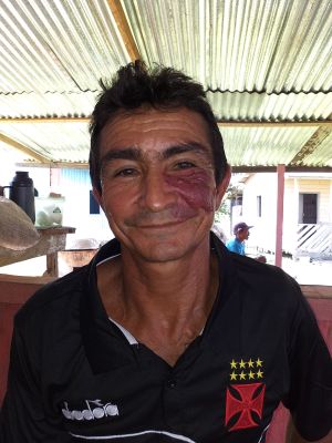 Joé Nilson Silva Feitosa
